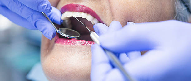Best Emergency Wisdom Tooth Extraction in Pine Hill, NJ